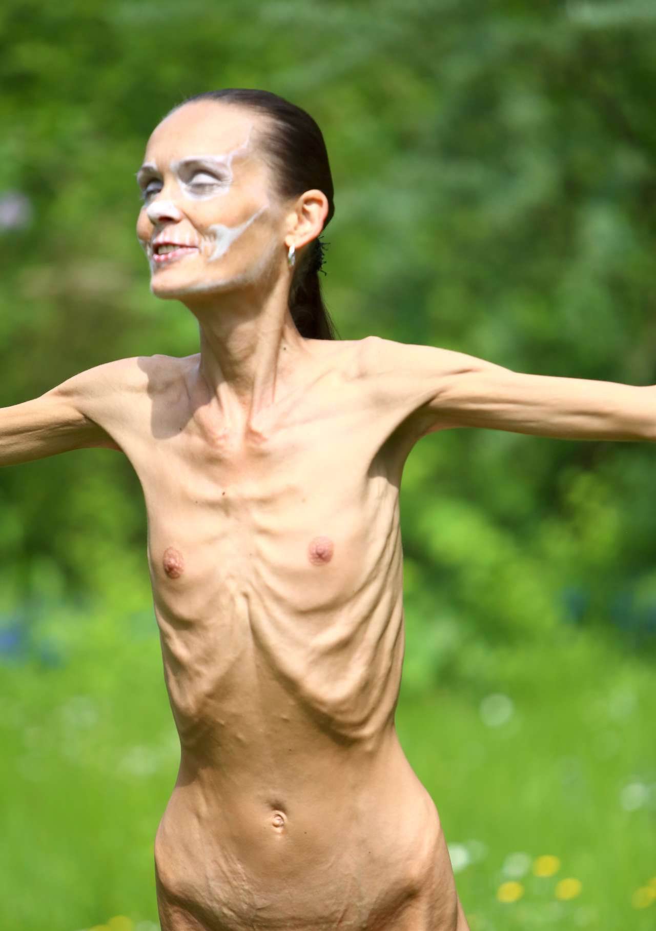 Anorexia nude model.