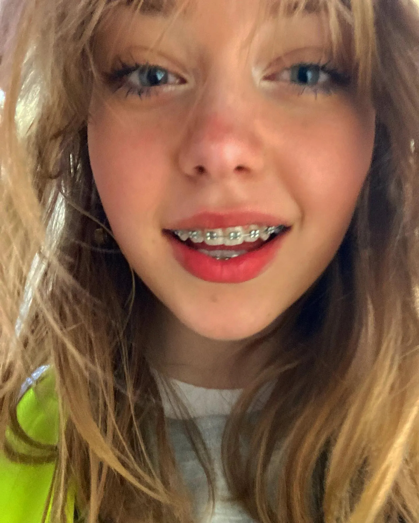 Cute Girls Braces